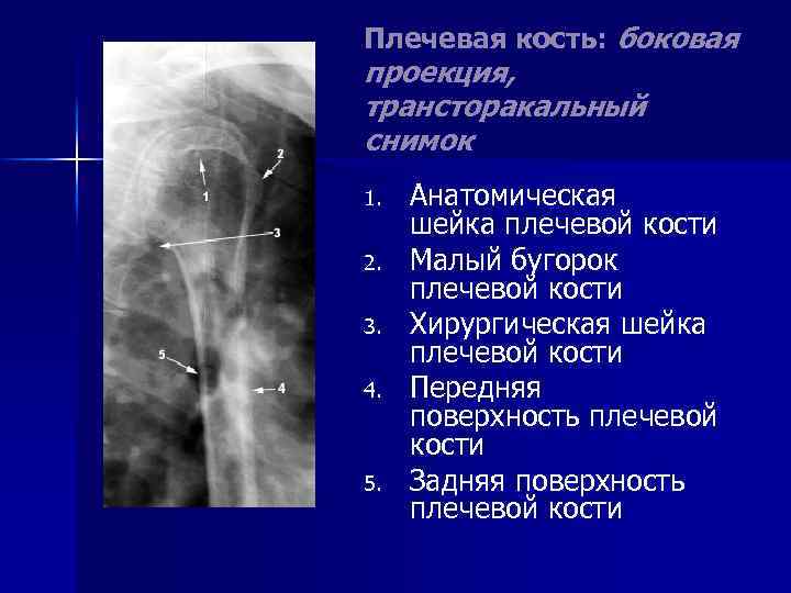 Рассмотрите рентгенограмму с изображением плечевого сустава человека как называют повреждение