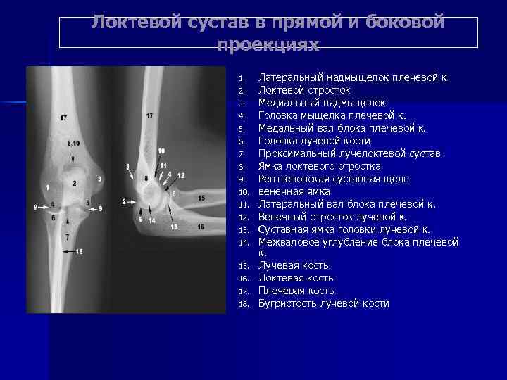 Локтевой сустав в прямой и боковой проекциях 1. 2. 3. 4. 5. 6. 7.