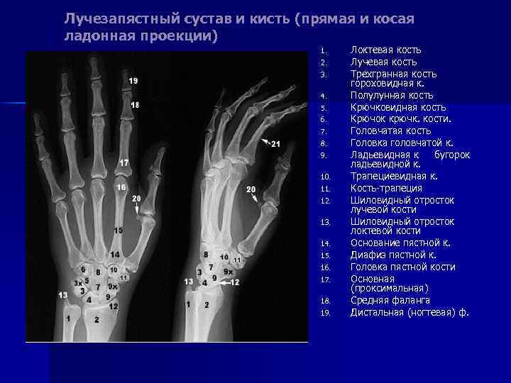 Лучезапястный сустав и кисть (прямая и косая ладонная проекции) 1. 2. 3. 4. 5.
