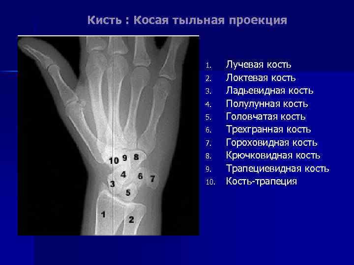 Кисть : Косая тыльная проекция 1. 2. 3. 4. 5. 6. 7. 8. 9.