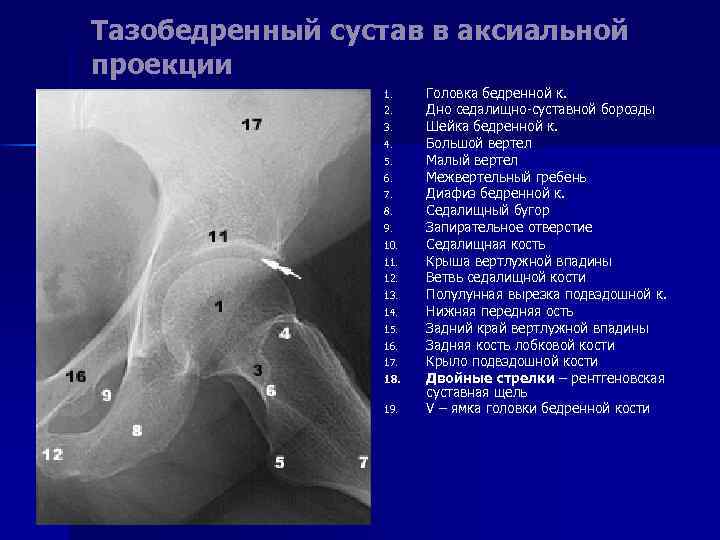 Тазобедренный сустав в аксиальной проекции 1. 2. 3. 4. 5. 6. 7. 8. 9.