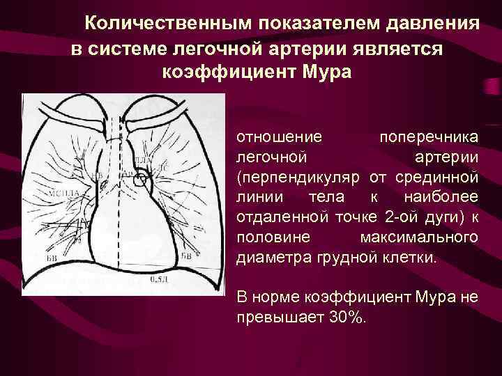 Рентгенологическую картину выпотного плеврита определяют