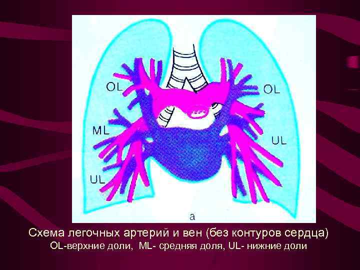 Схема легочных артерий и вен (без контуров сердца) ОL-верхние доли, ML- средняя доля, UL-