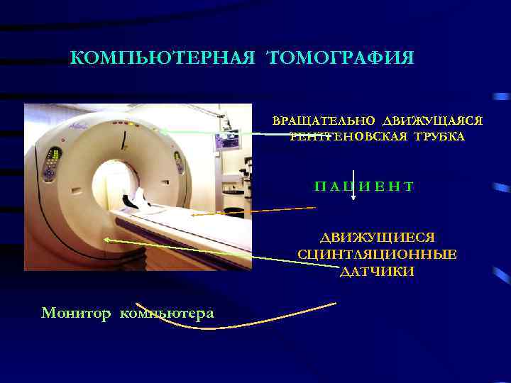 КОМПЬЮТЕРНАЯ ТОМОГРАФИЯ ВРАЩАТЕЛЬНО ДВИЖУЩАЯСЯ РЕНТГЕНОВСКАЯ ТРУБКА ПАЦИЕНТ ДВИЖУЩИЕСЯ СЦИНТЛЯЦИОННЫЕ ДАТЧИКИ Монитор компьютера 