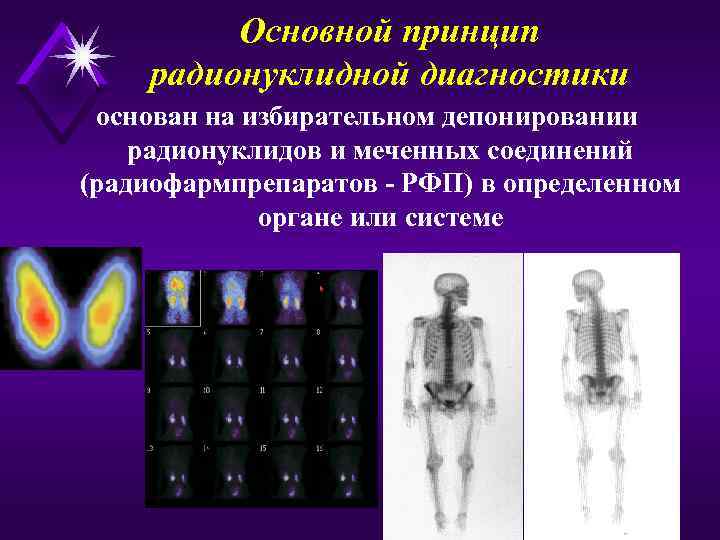 Основной принцип радионуклидной диагностики основан на избирательном депонировании радионуклидов и меченных соединений (радиофармпрепаратов -