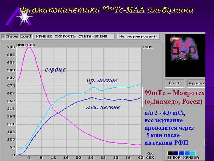 Фармакокинетика 99 m. Тс-МАА альбумина сердце пр. легкое лев. легкое 99 m. Тс –