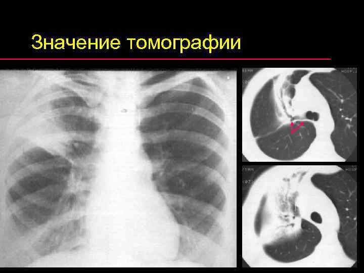 Значение томографии 