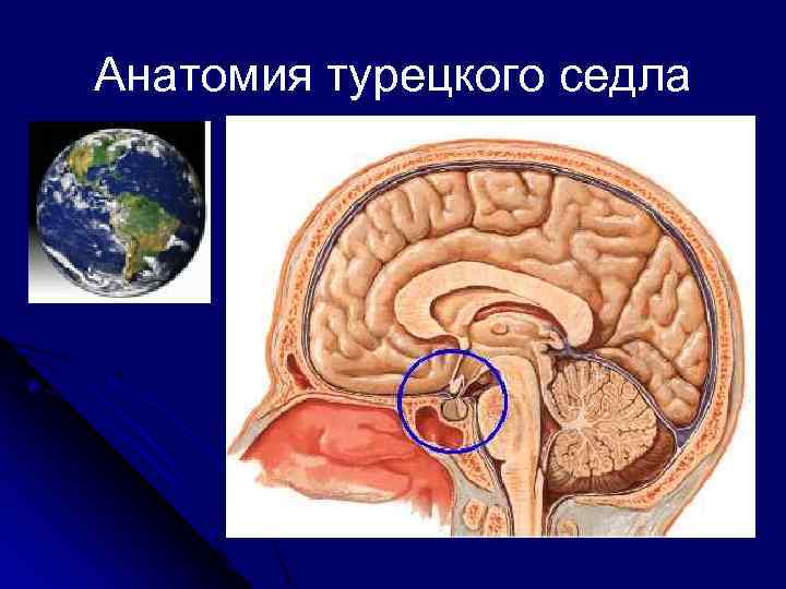 Гипофиз седло. Гипофиз в турецком седле. Анатомия турецкого седла в головном мозге. Гипофиз и турецкое седло на мрт. Диафрагма турецкого седла гипофиза.