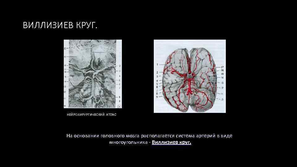Виллизиев круг что это такое. Виллизиев круг на кт. Атлас артерии головного мозга Виллизиев круг. Виллизиев круг УЗИ.