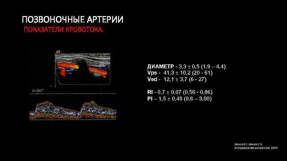 Диаметр позвоночной артерии