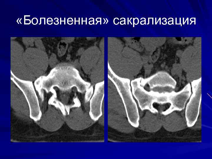  «Болезненная» сакрализация 