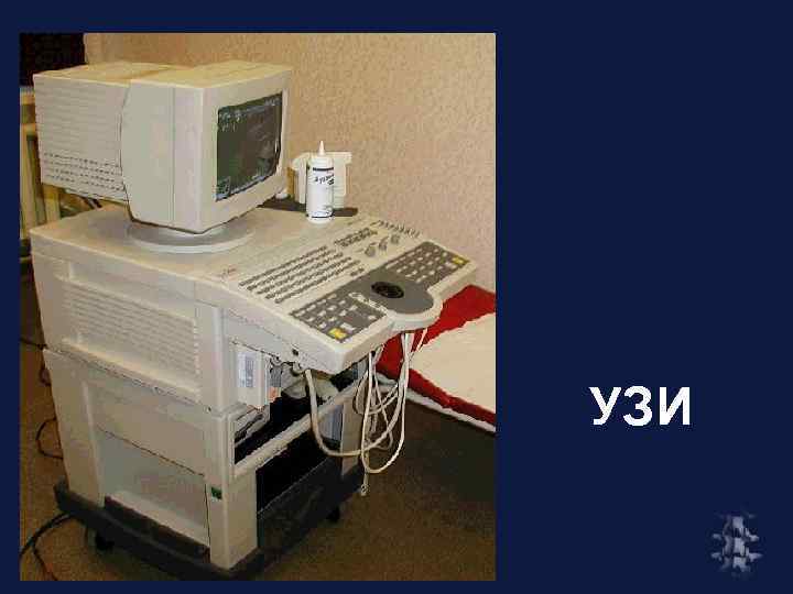 УЗИ 