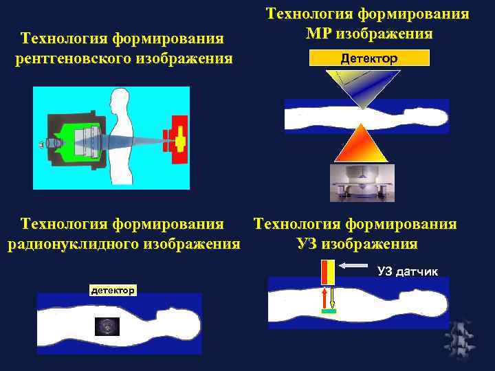 Технология формирования рентгеновского изображения Технология формирования МР изображения Детектор 2 Технология формирования радионуклидного изображения