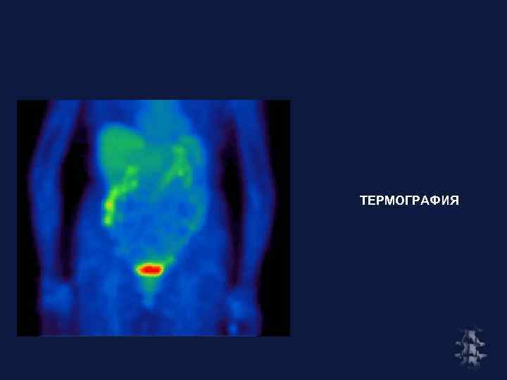 ТЕРМОГРАФИЯ 