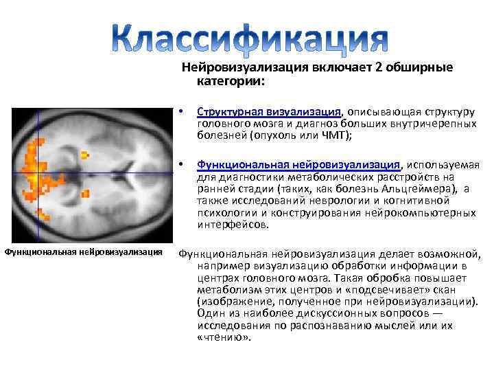  Нейровизуализация включает 2 обширные категории: • • Функциональная нейровизуализация Структурная визуализация, описывающая структуру