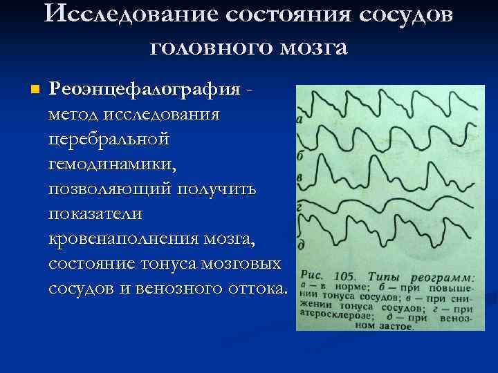 Исследование состояния сосудов головного мозга n Реоэнцефалография метод исследования церебральной гемодинамики, позволяющий получить показатели