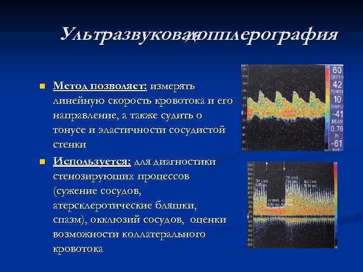 Ультразвуковая допплерография n n Метод позволяет: измерять линейную скорость кровотока и его направление, а