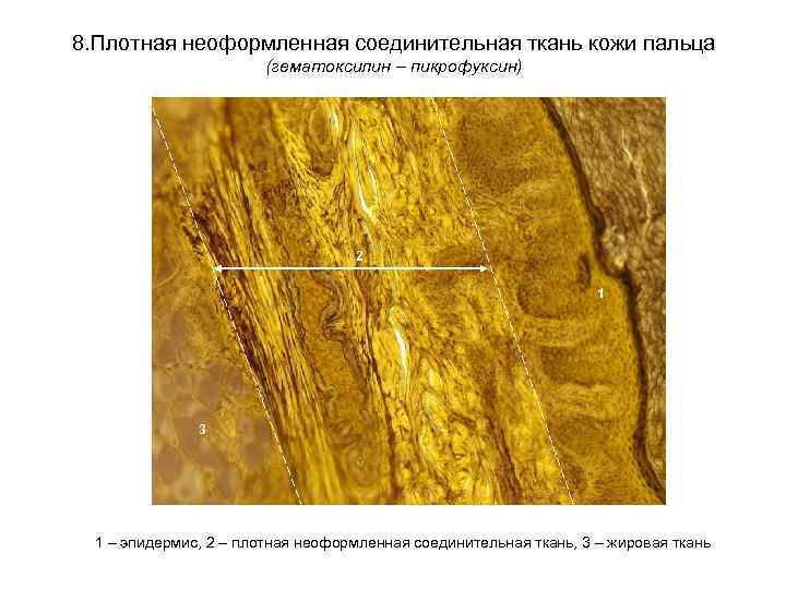 8. Плотная неоформленная соединительная ткань кожи пальца (гематоксилин – пикрофуксин) 2 1 3 1