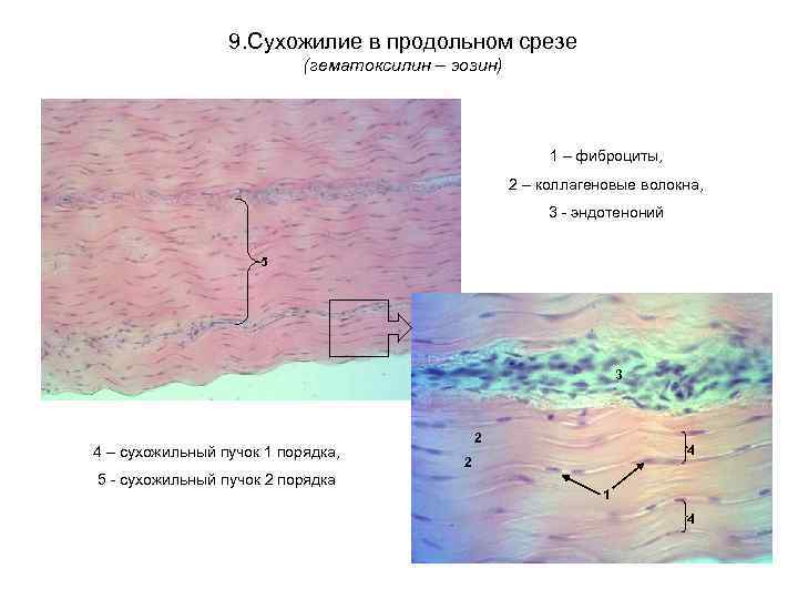 9. Сухожилие в продольном срезе (гематоксилин – эозин) 1 – фиброциты, 2 – коллагеновые