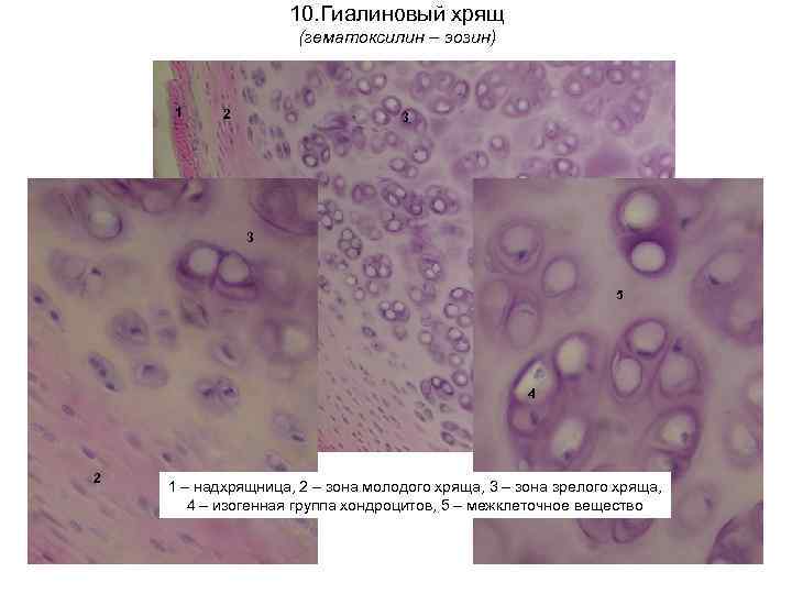 10. Гиалиновый хрящ (гематоксилин – эозин) 1 2 3 3 5 4 2 1