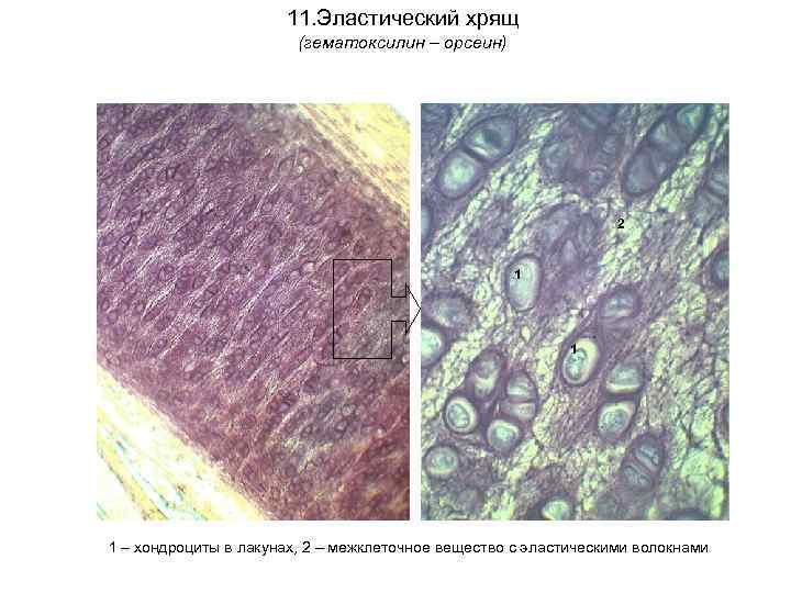 11. Эластический хрящ (гематоксилин – орсеин) 2 1 1 1 – хондроциты в лакунах,