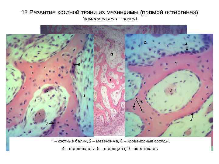 12. Развитие костной ткани из мезенхимы (прямой остеогенез) (гематоксилин – эозин) 2 4 3