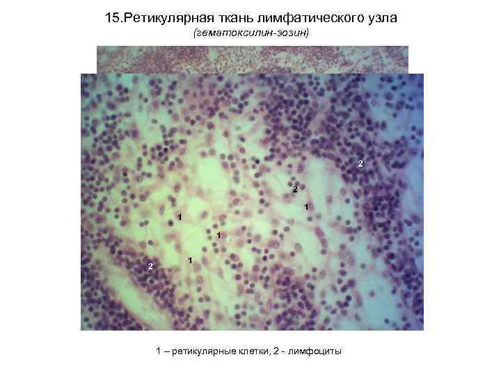 15. Ретикулярная ткань лимфатического узла (гематоксилин-эозин) 2 2 1 1 1 2 1 1