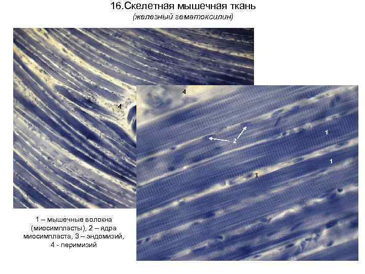 16. Скелетная мышечная ткань (железный гематоксилин) 4 4 1 2 1 3 1 –