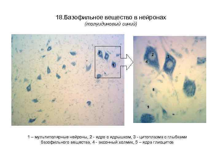 18. Базофильное вещество в нейронах (толуидиновый синий) 1 2 1 3 4 5 5