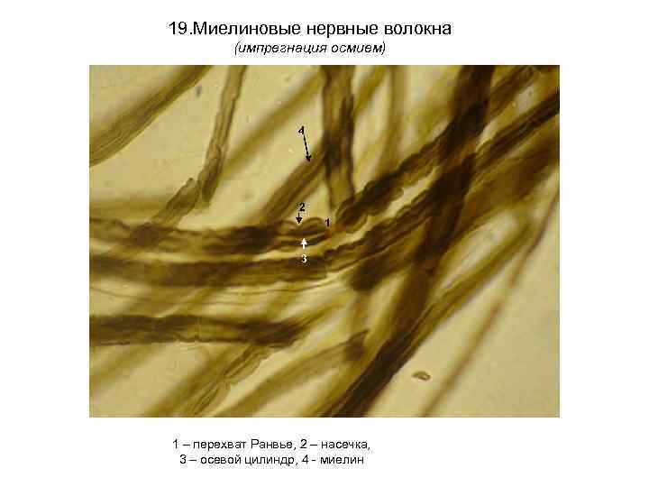 19. Миелиновые нервные волокна (импрегнация осмием) 4 2 1 3 1 – перехват Ранвье,