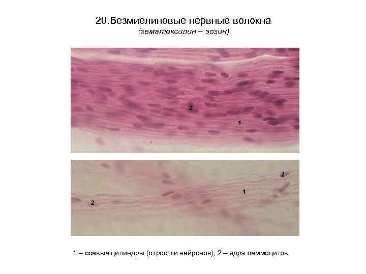 20. Безмиелиновые нервные волокна (гематоксилин – эозин) 2 1 2 1 – осевые цилиндры