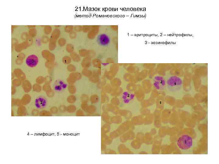21. Мазок крови человека (метод Романовского – Гимзы) 1 – эритроциты, 2 – нейтрофилы,