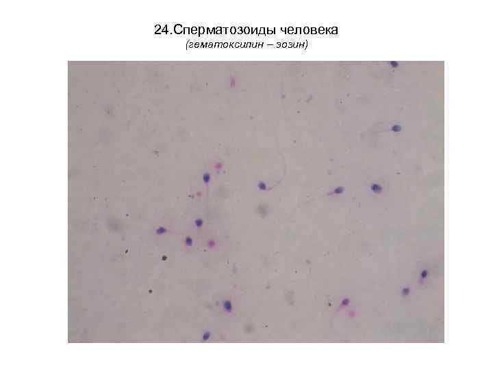 24. Сперматозоиды человека (гематоксилин – эозин) 