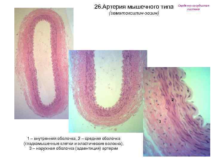 26. Артерия мышечного типа (гематоксилин-эозин) Сердечно-сосудистая система 1 2 3 1 – внутренняя оболочка,