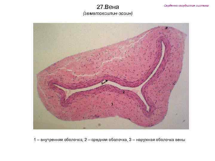 27. Вена Сердечно-сосудистая система (гематоксилин-эозин) 1 2 3 1 – внутренняя оболочка, 2 –