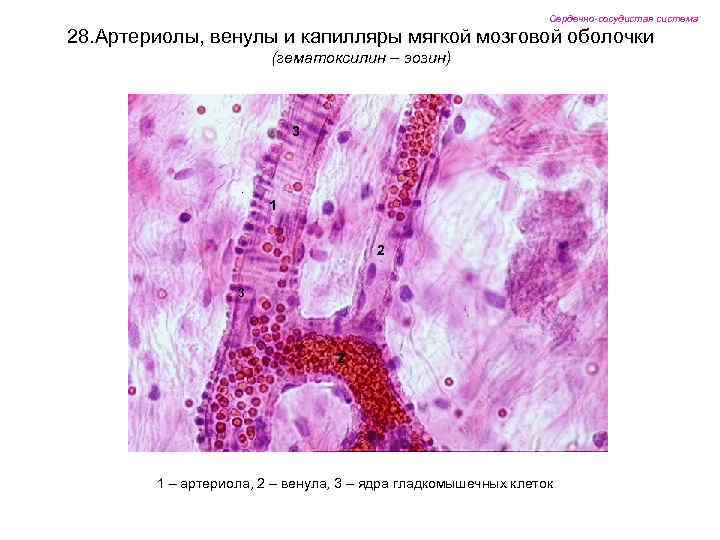 Сердечно-сосудистая система 28. Артериолы, венулы и капилляры мягкой мозговой оболочки (гематоксилин – эозин) 3