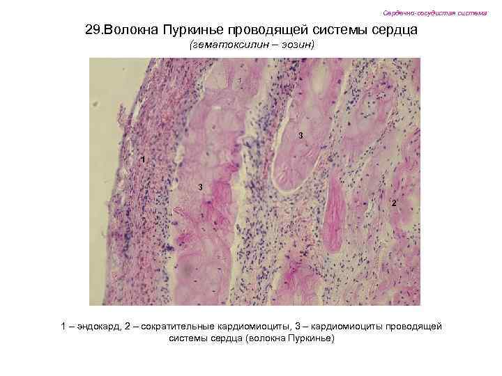 Сердечно-сосудистая система 29. Волокна Пуркинье проводящей системы сердца (гематоксилин – эозин) 3 1 3