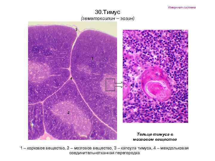 Иммунная система 30. Тимус (гематоксилин – эозин) 3 1 4 2 Тельце тимуса в