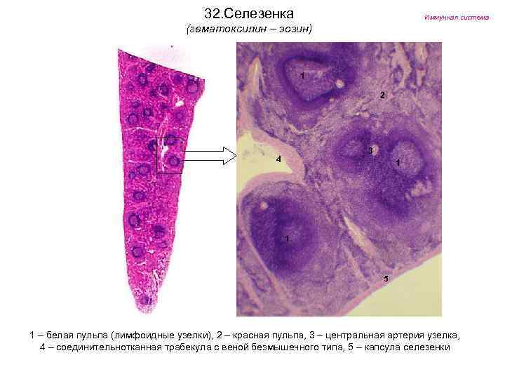 32. Селезенка Иммунная система (гематоксилин – эозин) 1 2 3 4 1 1 5