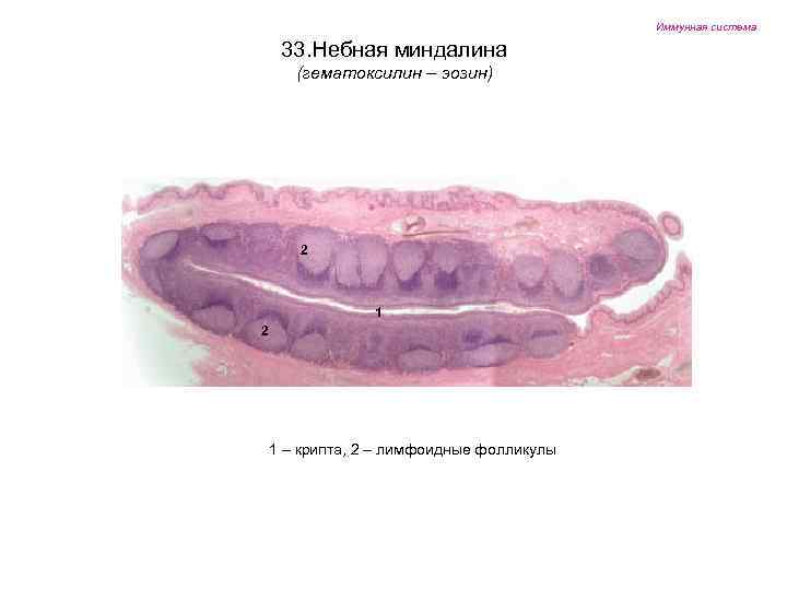 Иммунная система 33. Небная миндалина (гематоксилин – эозин) 2 1 – крипта, 2 –