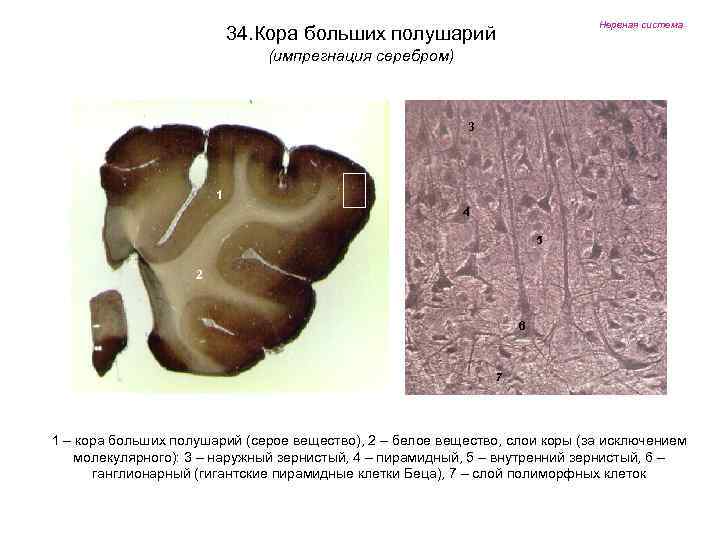 Нервная система 34. Кора больших полушарий (импрегнация серебром) 3 1 4 5 2 6