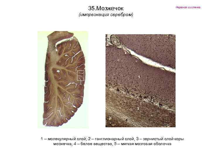 35. Мозжечок Нервная система (импрегнация серебром) 5 1 2 3 4 1 – молекулярный