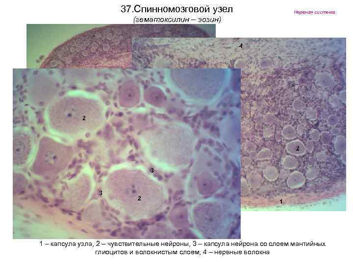 37. Спинномозговой узел Нервная система (гематоксилин – эозин) 4 2 2 3 3 2