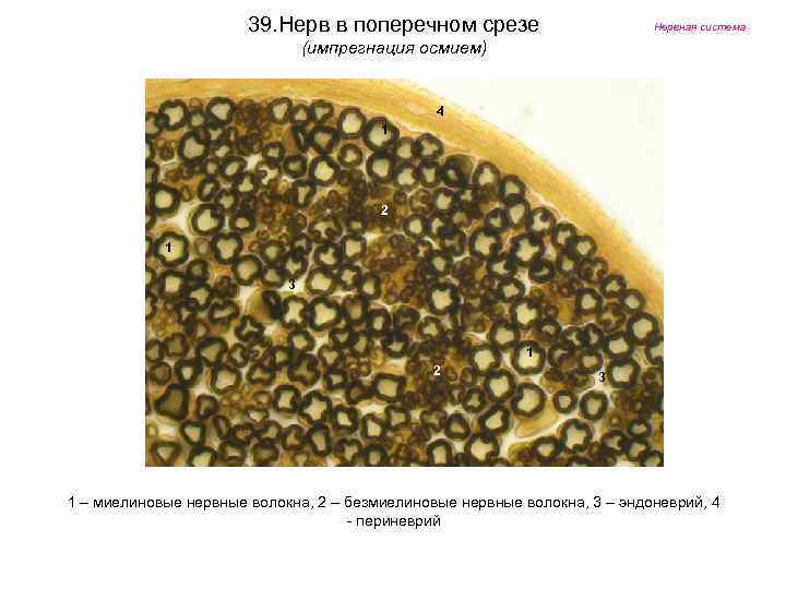 39. Нерв в поперечном срезе Нервная система (импрегнация осмием) 4 1 2 1 3