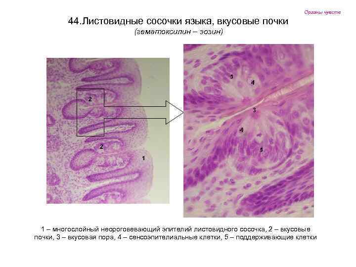 Органы чувств 44. Листовидные сосочки языка, вкусовые почки (гематоксилин – эозин) 5 4 2