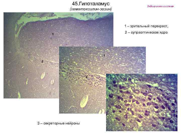 45. Гипоталамус Эндокринная система (гематоксилин-эозин) 1 – зрительный перекрест, 2 – супраоптическое ядро 1