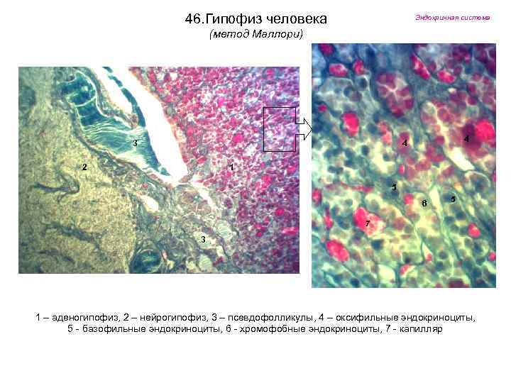 46. Гипофиз человека Эндокринная система (метод Маллори) 3 4 4 2 1 5 6