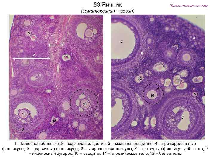 53. Яичник Женская половая система (гематоксилин – эозин) 1 5 3 2 4 7