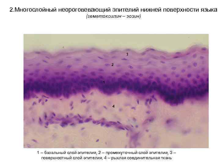2. Многослойный неороговевающий эпителий нижней поверхности языка (гематоксилин – эозин) 3 2 1 4