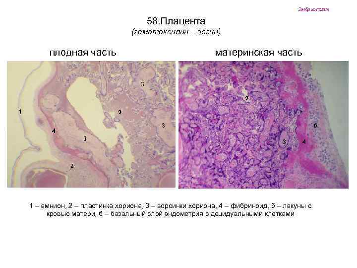 Эмбриология 58. Плацента (гематоксилин – эозин) плодная часть материнская часть 3 5 1 5